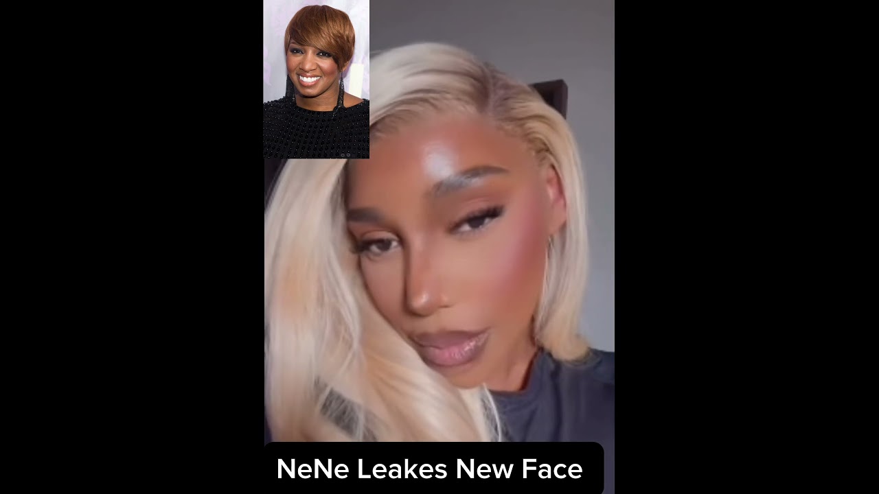 NeNe Leakes New Face #youtubeshorts #shorts