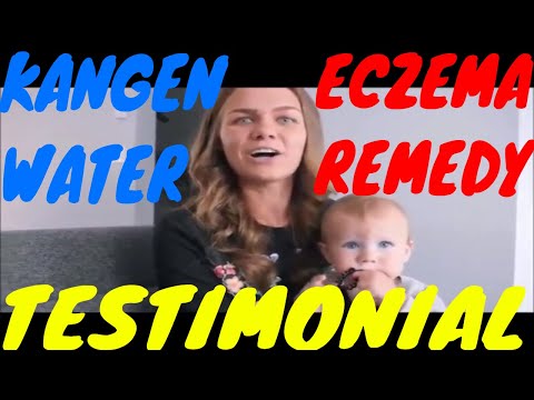 download lagu mp3 mp4 Kangen Water Eczema, download lagu Kangen Water Eczema gratis, unduh video klip Kangen Water Eczema