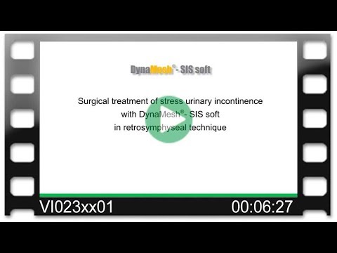 DynaMesh®-SIS soft - OR-Video: Surgical Treatment of Stress Urinary Incontinence in TVT Technique
