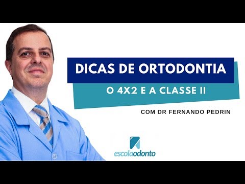 Dicas de ortodontia: O 4X2 e a Classe II