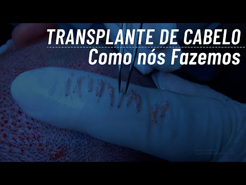 Capa do vídeo