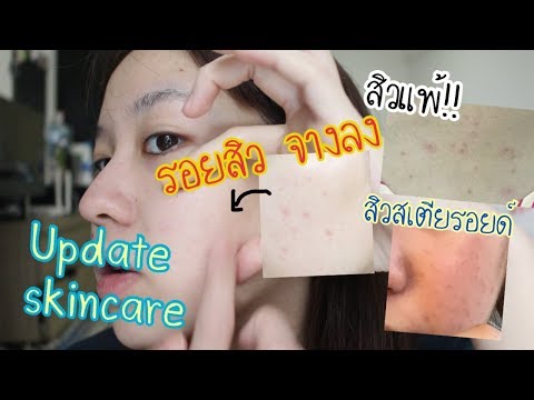 ความอ่อนแอประสาท ชาเพื่อเพิ่มความแข็งแรง