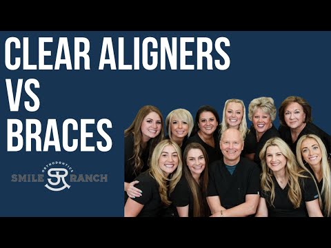 Clear Aligners vs Traditional Braces