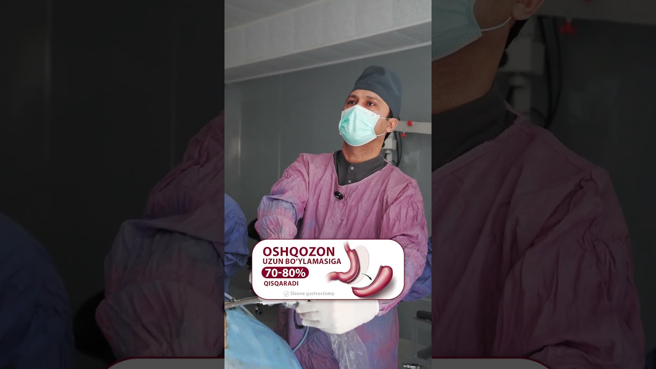 🩺 Dr. Ismoil Nazarov bilan xavfsiz bariatrik operatsiya 93 401 10 50