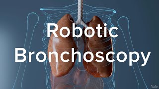 Newswise:Video Embedded how-robotic-bronchoscopy-helps-diagnose-lung-cancer