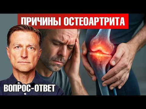 Из-за чего разрушаются суставы? Это не то, что вы думаете 🧐