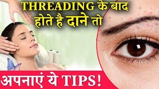 Here’re  Some Amazing Solution For prevent pimples after threading.