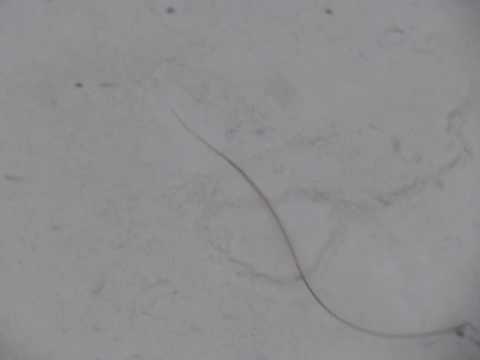 Come effettuare il trattamento di helminths Notizie sul primo su parassiti