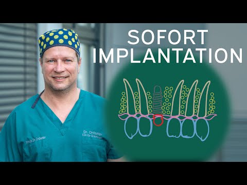 Video 9 Dr. Dröseler Praxis für Oralchirurgie Berlin