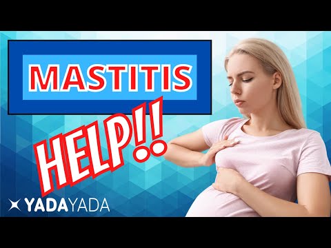 Mastitis - Can Physical Therapy help?  Treatment Options!