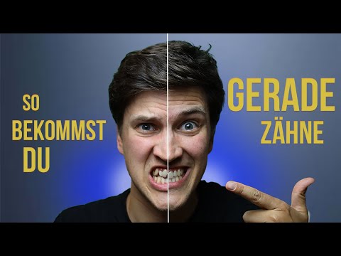Wie du gerade Zähne bekommst: Methoden für das perfekte Lächeln