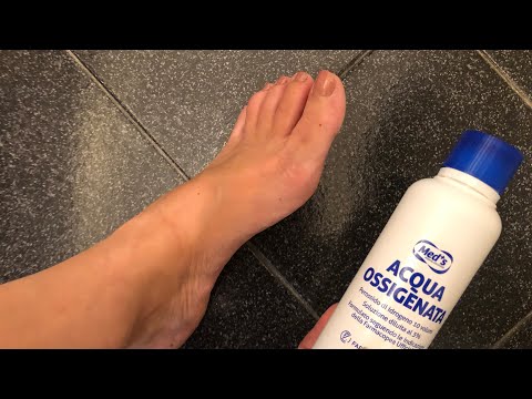 Metti l’acqua ossigenata sui piedi e guarda il risultato incredibile!Pedicure #perte #viral #tips 