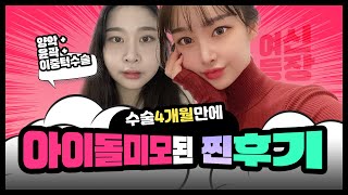 양악수술 안면윤곽 같이 ! 인생역전 아이돌미모 : ILUMI