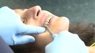 preview picture of video 'How Long Will My Orthodontic Appointment Be ? | BeecroftOrthodontics'