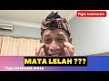 Tips Pijat Mata Lelah Mata Kabur Sebelah Saraf Mata Terganggu Mata Silau Melihat Penglihatan Kabur