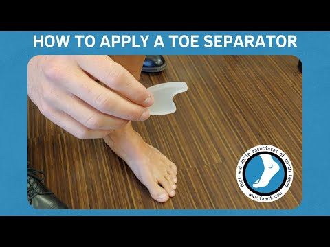 How to Apply a Toe Separator