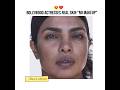 Real Skin Texture Bollywood Actress Youtubeshorts Youtube Shorts Shortfeed