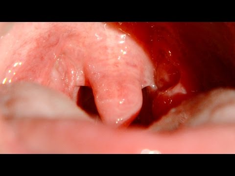 Slow Mo Gargling Uvula - The Slow Mo Guys