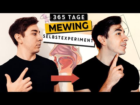 365 Days of Mewing - Get an attractive face through tongue position (Mewing German)