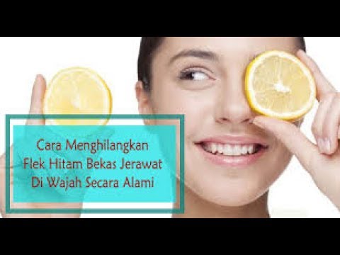 download lagu mp3 mp4 Cara Menghilangkan Jerawat Flek Hitam Dengan Lemon, download lagu Cara Menghilangkan Jerawat Flek Hitam Dengan Lemon gratis, unduh video klip Cara Menghilangkan Jerawat Flek Hitam Dengan Lemon