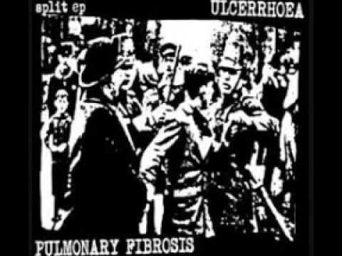 Pulmonary Fibrosis Schizophrenia and Purulenta/Pulmonis Infection