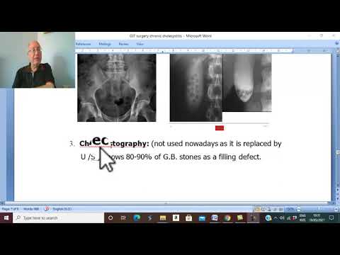 Biliary  disorders in Arabic 7 ( Chronic Cholecystitis , part 3 ) , by Dr. Wahdan