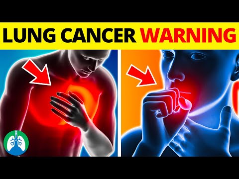 Top 10 Early Warning Signs of Lung Cancer | NEVER IGNORE THIS