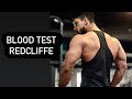Full Body Checkup at home | Redcliffe Labs | Redcliffe Labs Review