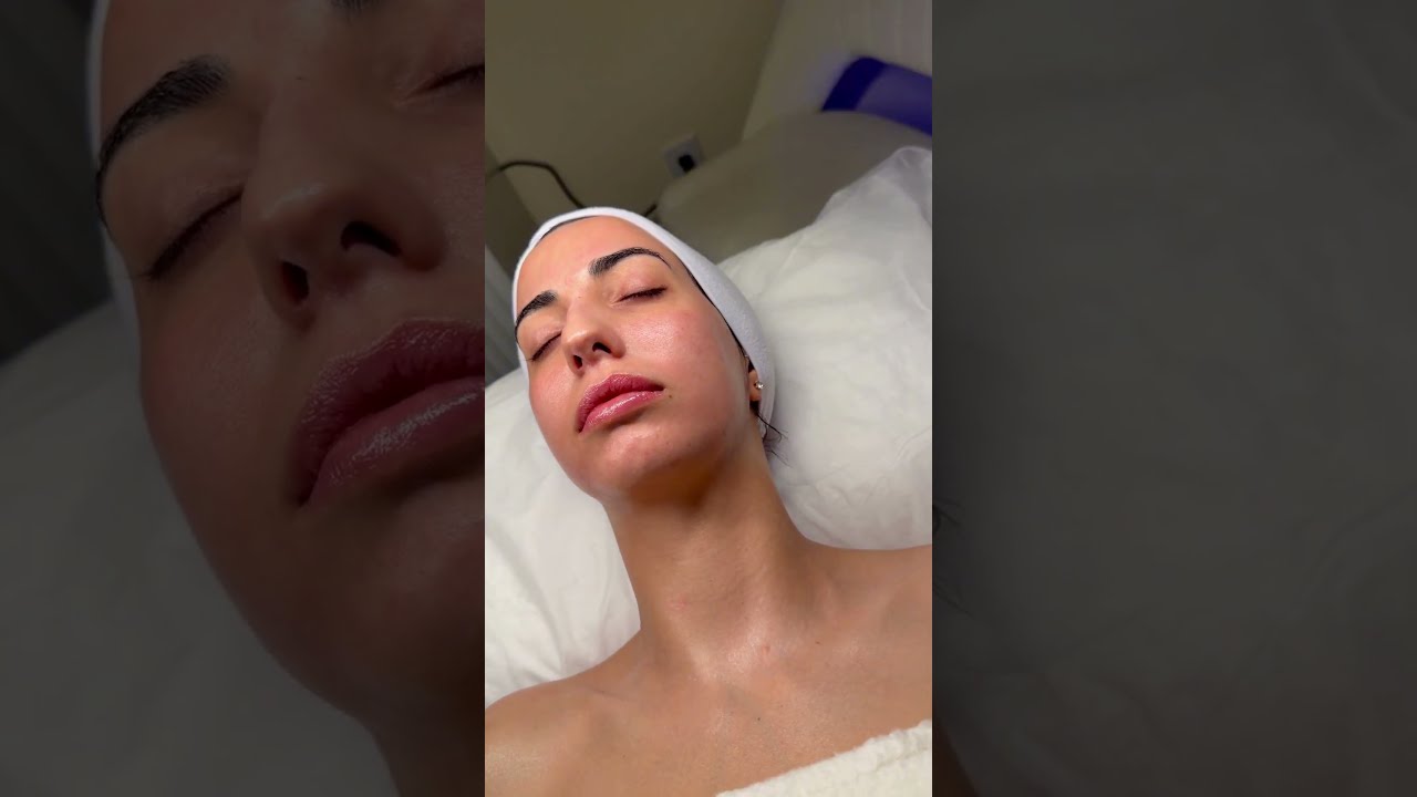Exosomes & Salmon DNA & stem cells #skintreatment This advanced treatment helps to: • Soften fine lines and early wrinkles • Reduce the look of acne scars and texture • Minimize large pores • Brighten dull, tired, sun-damaged skin • Boost collagen, firmness, and long-lasting hydration What’s included in the facial: • Double cleanse + skin prep • Topical numbing cream for comfort • Professional microneedling treatment • Salmon DNA (PDRN) + advanced serum infusion • Calming PDRN mask • LED light therapy • Moisturizer + SPF protection Lumière B
