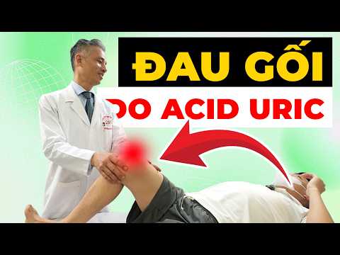 Đau Khớp Gối Do Acid Uric Cao – 80% Người Đang Hiểu Sai
