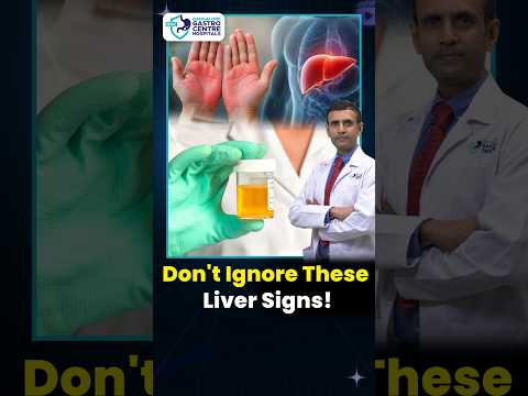 Hidden Signs Your Liver Is Damaged! 😳 Most People Miss These #shorts