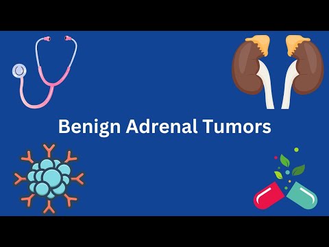 Benign adrenal tumors: What You Need To Know