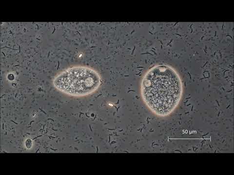 Wilfrieds Mikroskopvideos: Einzeller im Heuaufguss