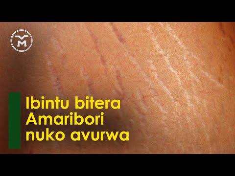 00136: AMARIBORI || IBINTU BIYATERA || ABANTU BAYAGIRA || IBICE BY'UMUBIRI AZAHO || UBURYO AVURWA