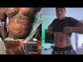 Bandman Kevo GETS Liposuction\ bbl | What i think about Lipo