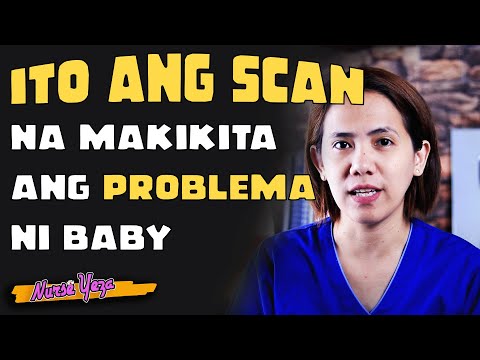 ANO ANG CONGENITAL ANOMALY SCAN