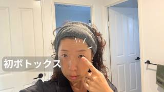 40代海外主婦のリアル美容|ボトックスと毎日のスキンケア