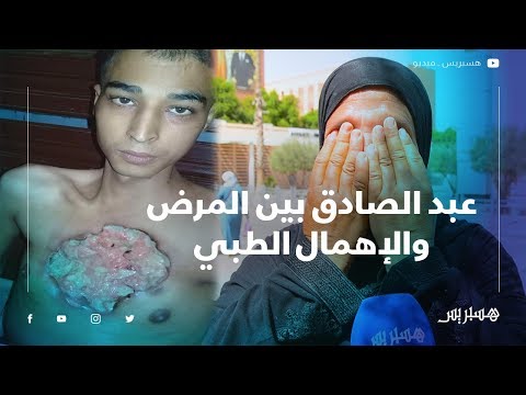 مرض السل يعفن صدرعبد الصادق.. ووالدته تناشد المسؤولين "بغيتهوم هير إعالجوه القلب ديالو ولا كيبان"