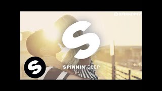 NERVO &amp; Marco Lys - Don&#39;t Break My Heart (OUT NOW)