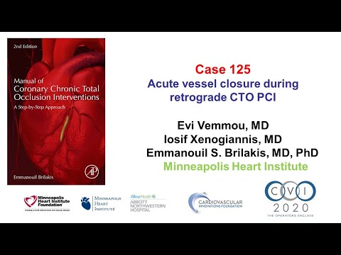 Case 125: Manual of CTO interventions - Acute vessel closure during retrograde CTO PCI