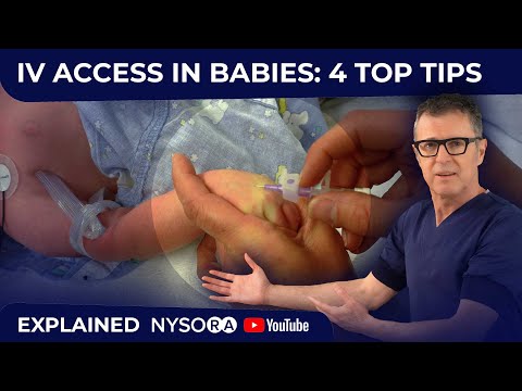 IV Access in Babies: 4 TOP TIPS