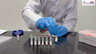 MBPCR182  -  Hi‐PCR® Hepatitis C Virus(HCV) Detection and Quantitation Probe PCR Kit.