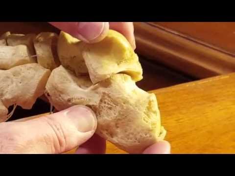 Subtalar Joint Range of Motion With Foot Skeleton