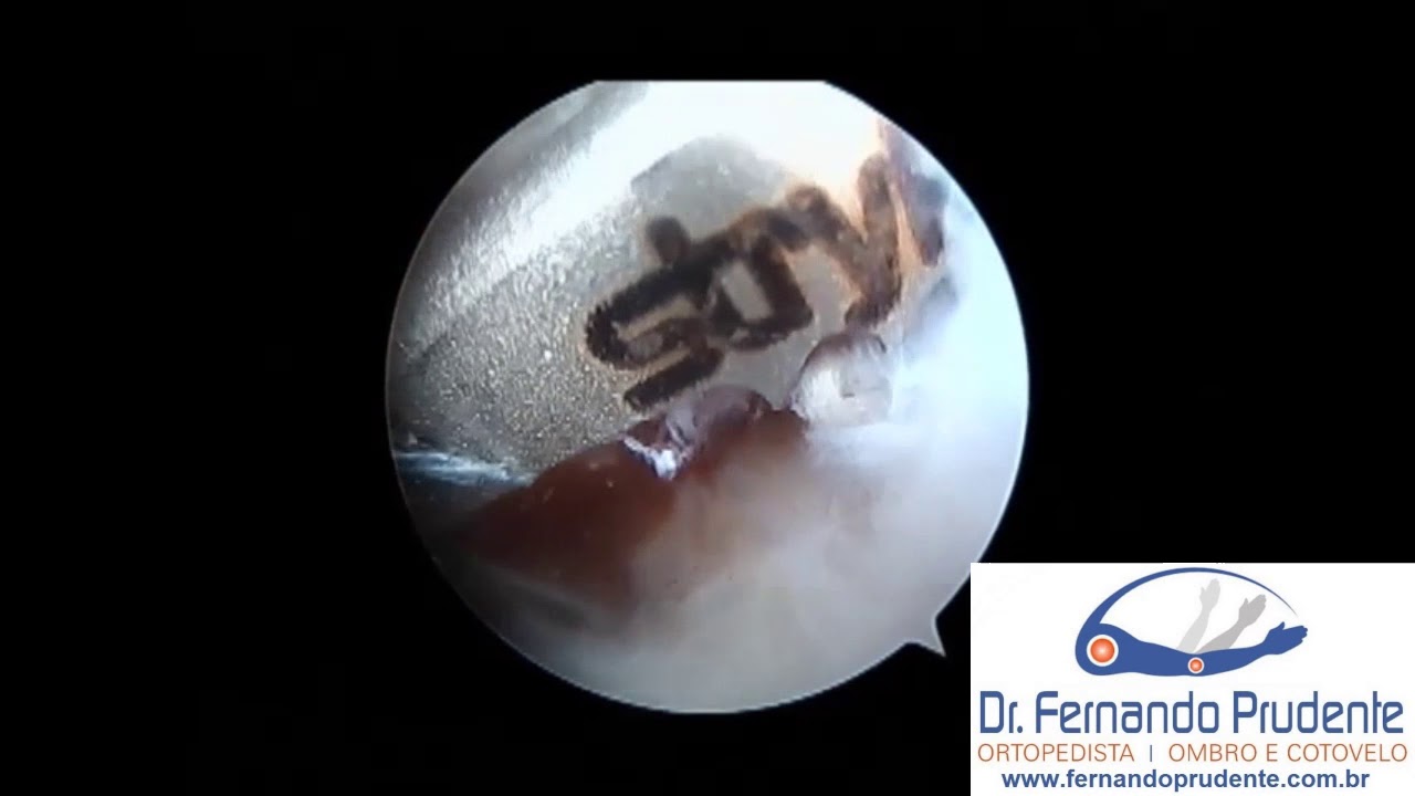 Fernando Prudente Gonçalves-6