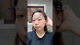 オーストラリアで肌悩みがある方へ#オーストラリアワーホリ #メルボルン生活 #海外生活