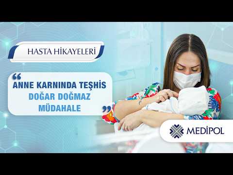 Doğumsal Kalp Hastalığı: Büyük Arter Transpozisyonu ve Tedavi Süreci