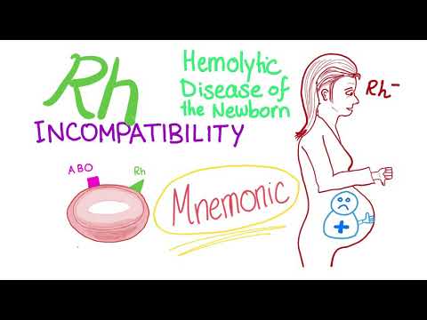Rh incompatibility - Mnemonic - Hemolytic disease of the newborn (HDN) - Erythroblastosis fetalis