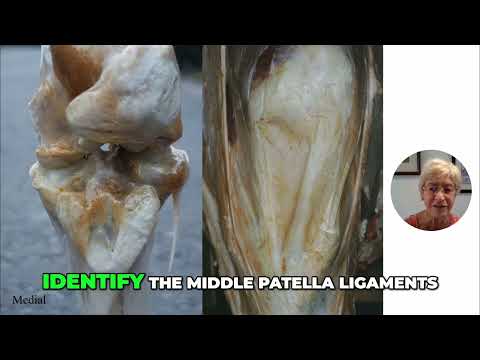 How to Palpate the Equine Stifle Joint: Key Muscles and Ligaments