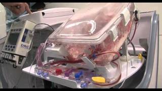 Heart in a Box: UCLA patient's life-saving donor heart arrives 'warm and beating' inside box video