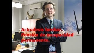 Artrodesis lumbar y pensión de incapacidad permanente.